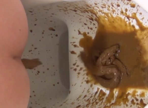 糞飛沫がハンパない素人娘の下痢便！他にも色んなウンコが見れるよ！