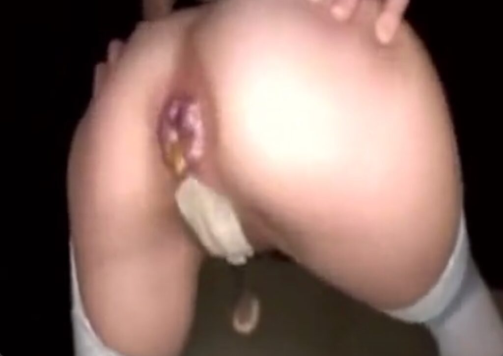 ケツ振りダンスをしながらウンコを垂れ流すヤバい女がこちらｗ