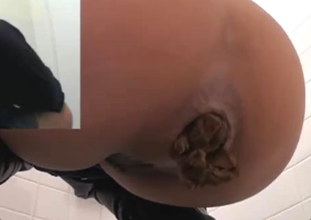 女のアナルの伸縮性ってやっぱすげえわ！デカすぎだろこのウンコｗ