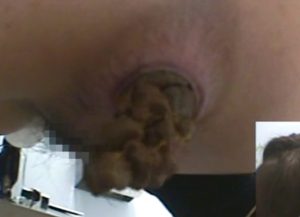 こういうゴツゴツした女のウンコって結構食べやすかったりするんだよなｗ
